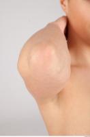 Elbow texture of Casey 0002